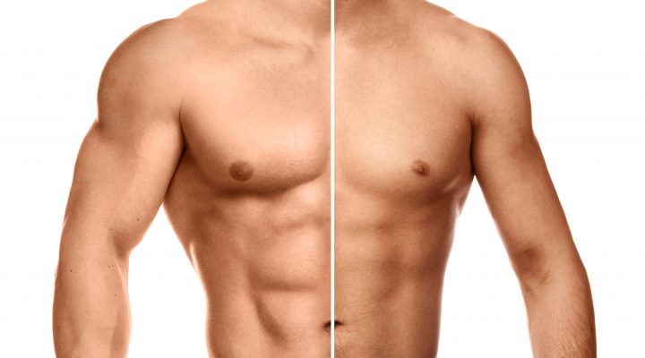 hipertrofia-santi-jacomet-orthos